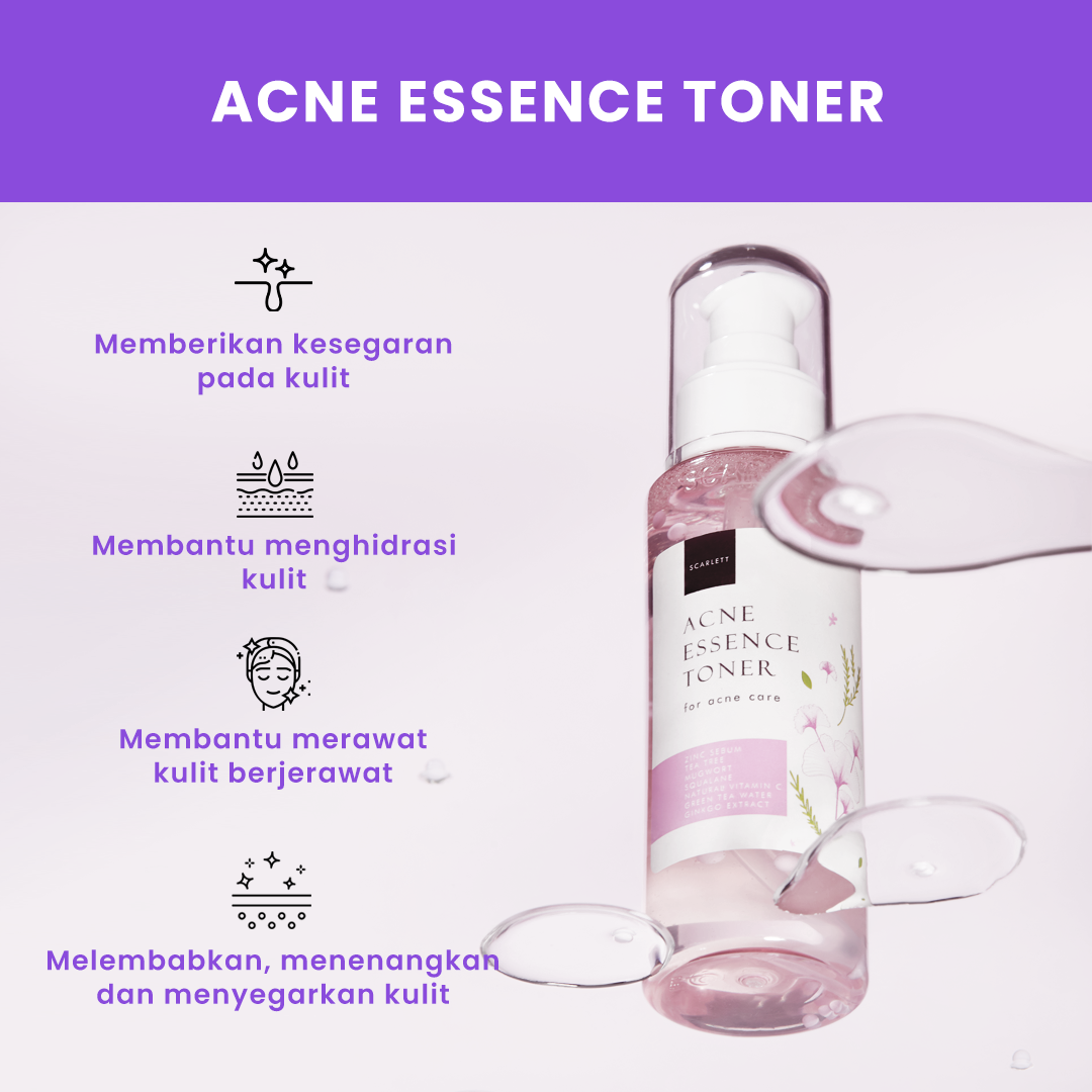 Acne Essence Toner